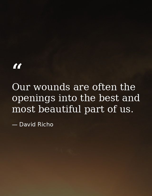 Our wounds are often the openings into the best and most beautiful part of us. — David Richo
