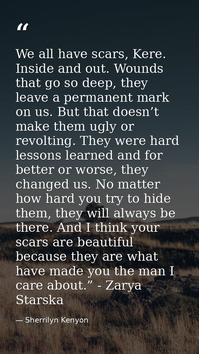 We all have scars, Kere. Inside and out. Wounds that go so deep, they leave a permanent mark on us. But that doesn’t mak — Sherrilyn Kenyon
