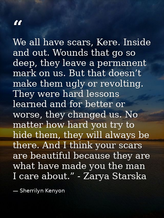 We all have scars, Kere. Inside and out. Wounds that go so deep, they leave a permanent mark on us. But that doesn’t mak — Sherrilyn Kenyon