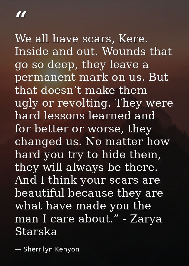 We all have scars, Kere. Inside and out. Wounds that go so deep, they leave a permanent mark on us. But that doesn’t mak — Sherrilyn Kenyon
