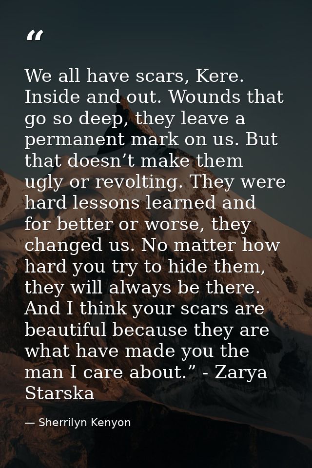 We all have scars, Kere. Inside and out. Wounds that go so deep, they leave a permanent mark on us. But that doesn’t mak — Sherrilyn Kenyon