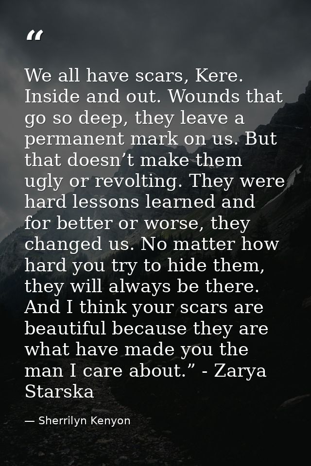 We all have scars, Kere. Inside and out. Wounds that go so deep, they leave a permanent mark on us. But that doesn’t mak — Sherrilyn Kenyon