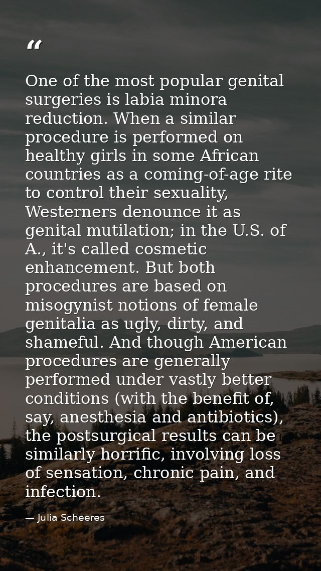 One of the most popular genital surgeries is labia minora reduction. When a similar procedure is performed on healthy gi — Julia Scheeres