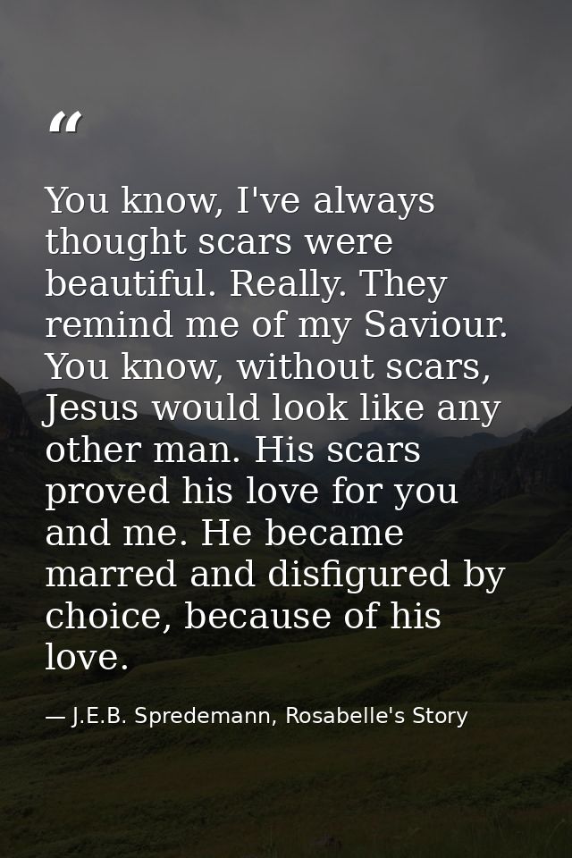 You know, I've always thought scars were beautiful. Really. They remind me of my Saviour. You know, without scars, Jesus — J.E.B. Spredemann, Rosabelle's Story