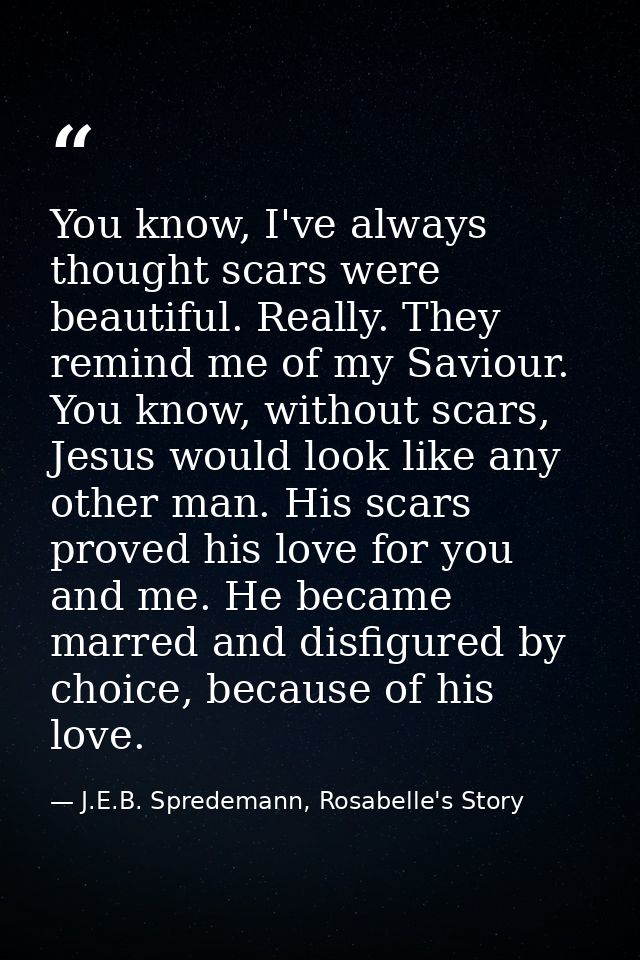 You know, I've always thought scars were beautiful. Really. They remind me of my Saviour. You know, without scars, Jesus — J.E.B. Spredemann, Rosabelle's Story