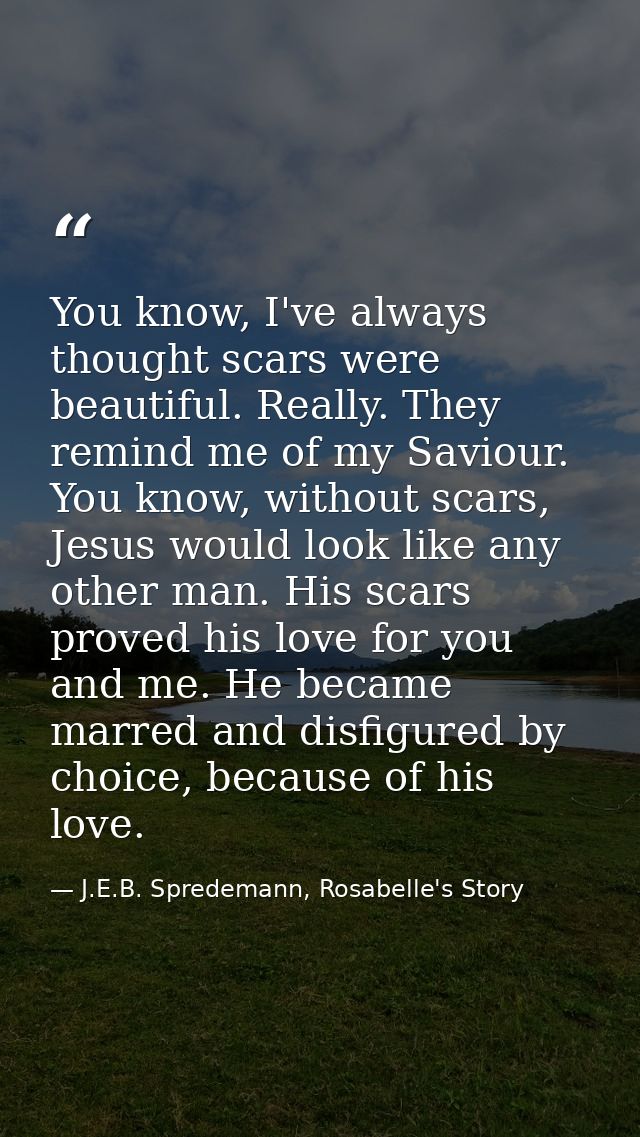 You know, I've always thought scars were beautiful. Really. They remind me of my Saviour. You know, without scars, Jesus — J.E.B. Spredemann, Rosabelle's Story