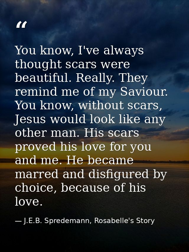 You know, I've always thought scars were beautiful. Really. They remind me of my Saviour. You know, without scars, Jesus — J.E.B. Spredemann, Rosabelle's Story