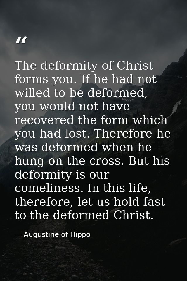 The deformity of Christ forms you. If he had not willed to be deformed, you would not have recovered the form which you  — Augustine of Hippo