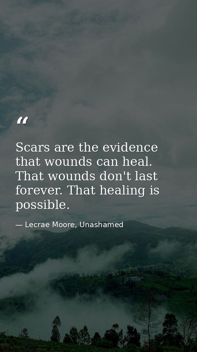 Scars are the evidence that wounds can heal. That wounds don't last forever. That healing is possible. — Lecrae Moore, Unashamed