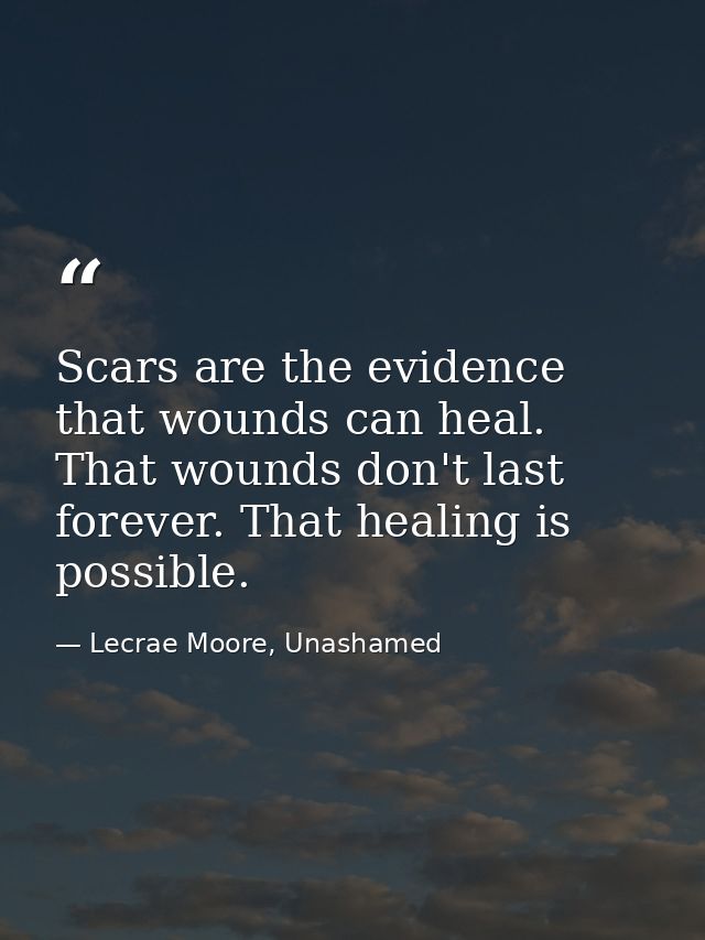 Scars are the evidence that wounds can heal. That wounds don't last forever. That healing is possible. — Lecrae Moore, Unashamed