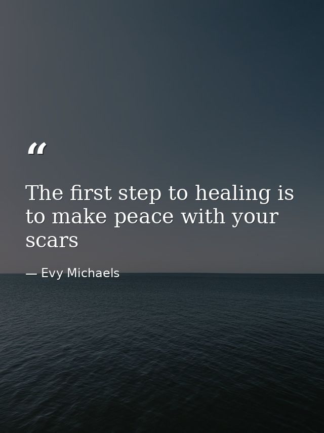 The first step to healing is to make peace with your scars — Evy Michaels