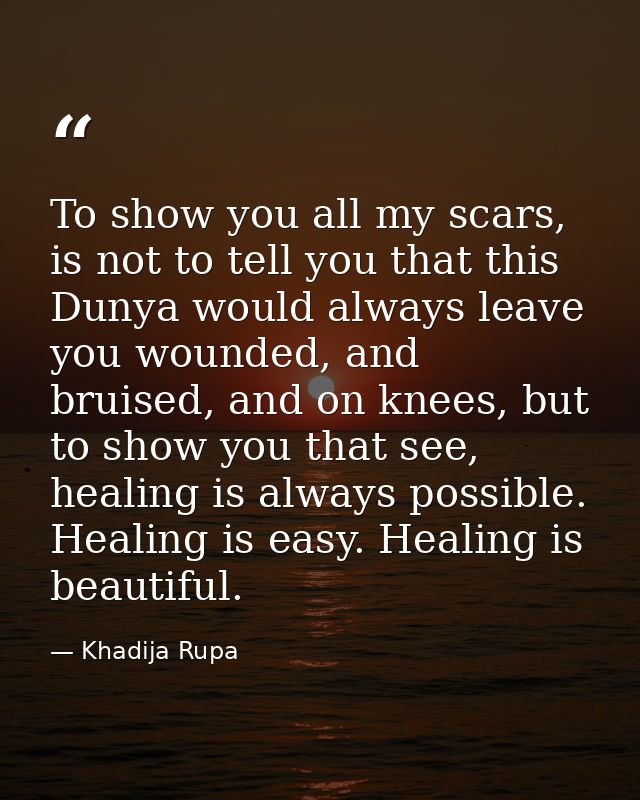 To show you all my scars, is not to tell you that this Dunya would always leave you wounded, and bruised, and on knees,  — Khadija Rupa