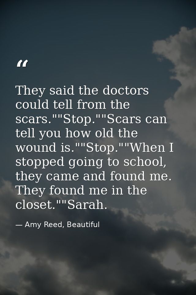 They said the doctors could tell from the scars.""Stop.""Scars can tell you how old the wound is.""Stop.""When I stopped — Amy Reed, Beautiful