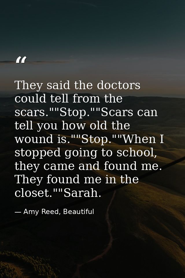 They said the doctors could tell from the scars.""Stop.""Scars can tell you how old the wound is.""Stop.""When I stopped — Amy Reed, Beautiful