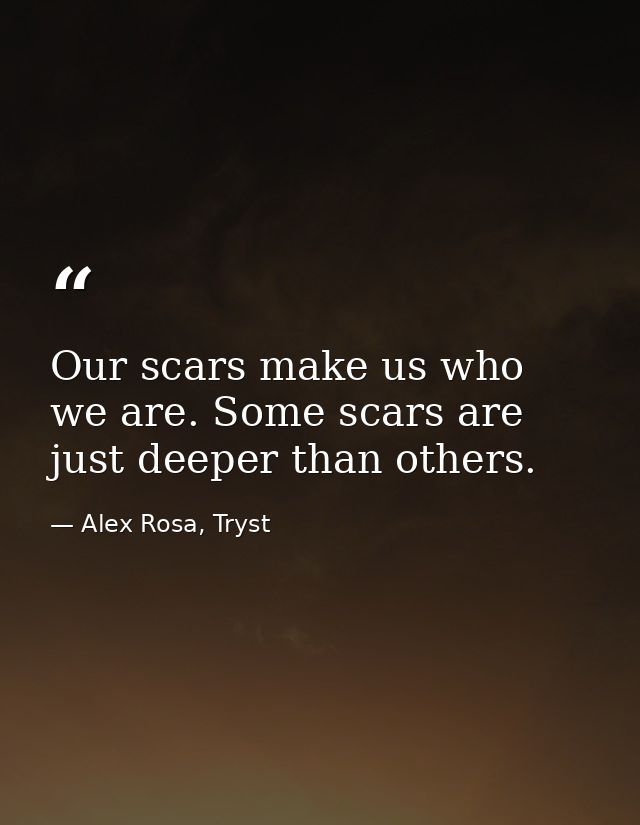 Our scars make us who we are. Some scars are just deeper than others. — Alex Rosa, Tryst