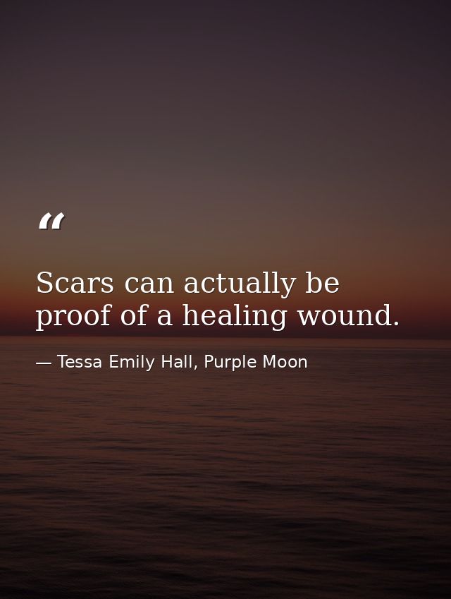 Scars can actually be proof of a healing wound. — Tessa Emily Hall, Purple Moon