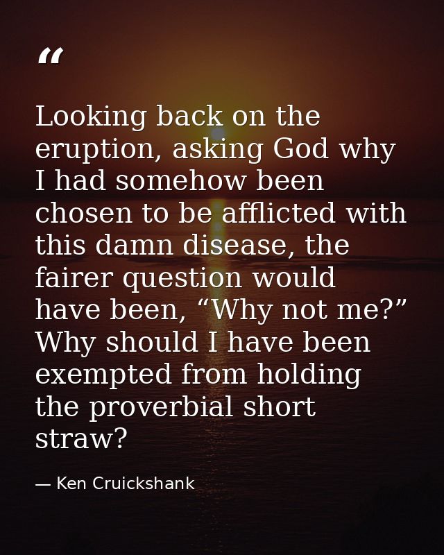 Looking back on the eruption, asking God why I had somehow been chosen to be afflicted with this damn disease, the faire — Ken Cruickshank