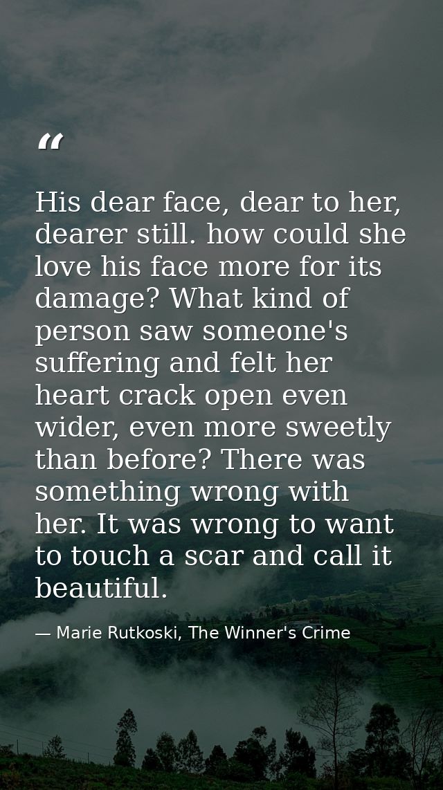 His dear face, dear to her, dearer still. how could she love his face more for its damage? What kind of person saw someo — Marie Rutkoski, The Winner's Crime