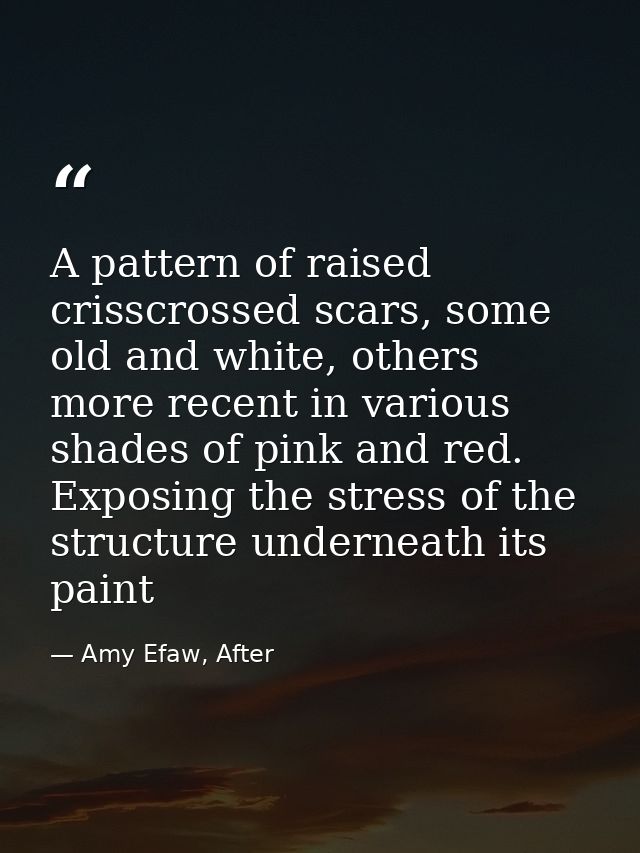A pattern of raised crisscrossed scars, some old and white, others more recent in various shades of pink and red. Exposi — Amy Efaw, After