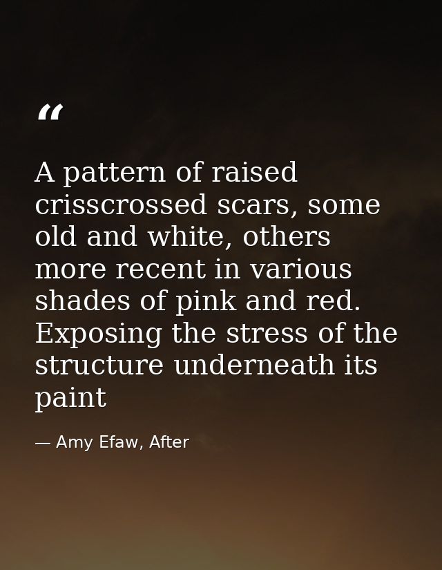 A pattern of raised crisscrossed scars, some old and white, others more recent in various shades of pink and red. Exposi — Amy Efaw, After