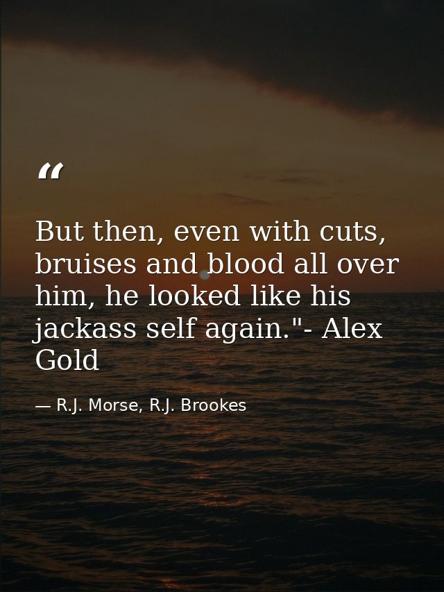 But then, even with cuts, bruises and blood all over him, he looked like his jackass self again."- Alex Gold — R.J. Morse, R.J. Brookes
