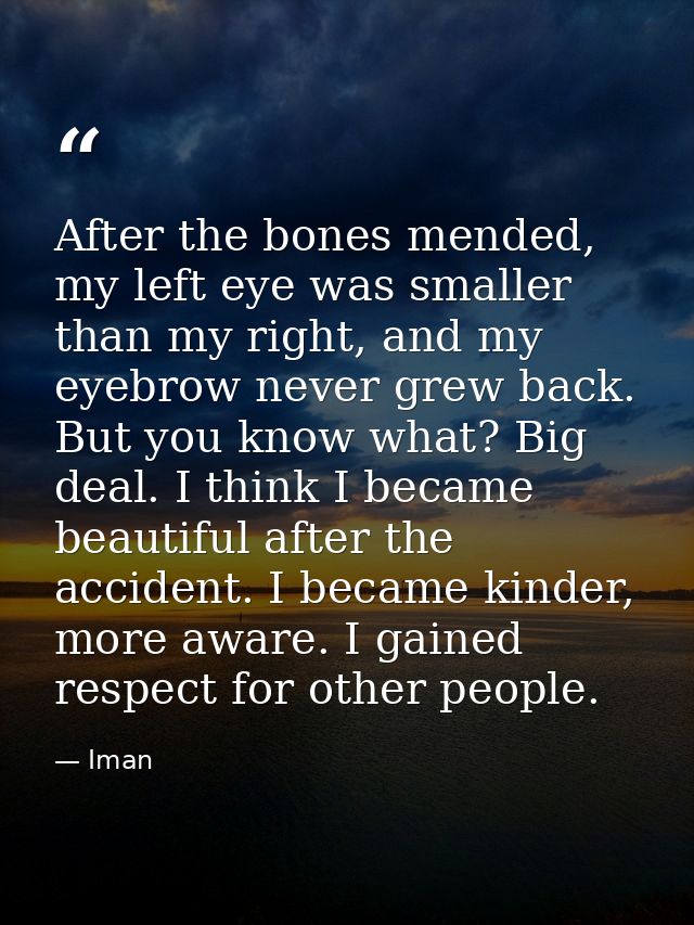 After the bones mended, my left eye was smaller than my right, and my eyebrow never grew back. But you know what? Big de — Iman