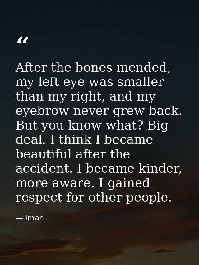 After the bones mended, my left eye was smaller than my right, and my eyebrow never grew back. But you know what? Big de — Iman
