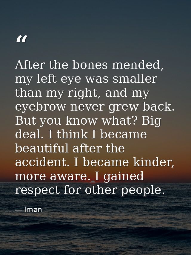 After the bones mended, my left eye was smaller than my right, and my eyebrow never grew back. But you know what? Big de — Iman