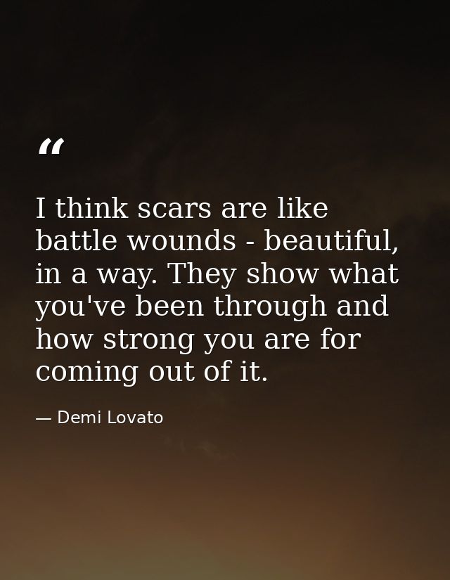 I think scars are like battle wounds - beautiful, in a way. They show what you've been through and how strong you are fo — Demi Lovato