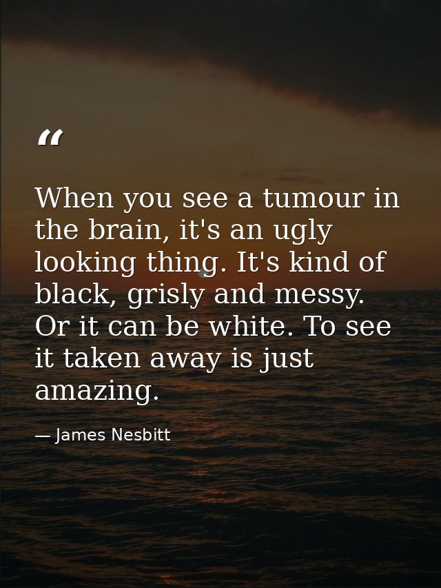 When you see a tumour in the brain, it's an ugly looking thing. It's kind of black, grisly and messy. Or it can be white — James Nesbitt