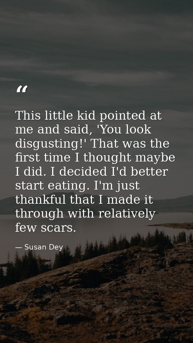 This little kid pointed at me and said, 'You look disgusting!' That was the first time I thought maybe I did. I decided  — Susan Dey