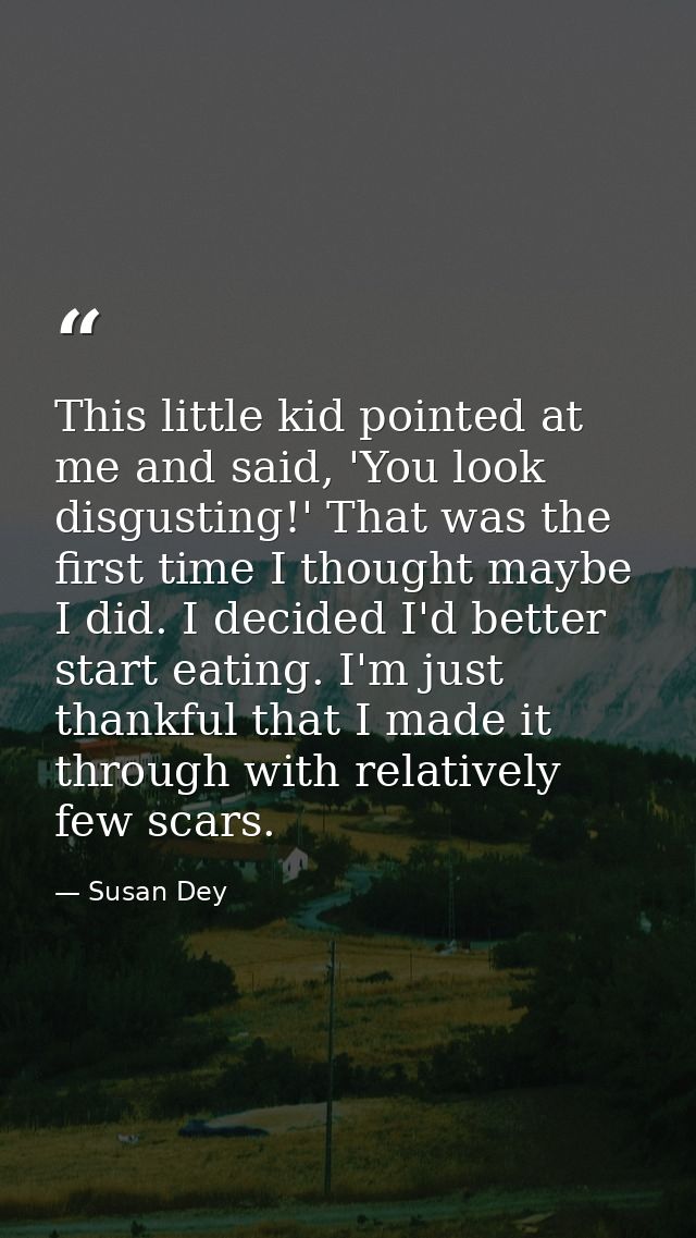 This little kid pointed at me and said, 'You look disgusting!' That was the first time I thought maybe I did. I decided  — Susan Dey