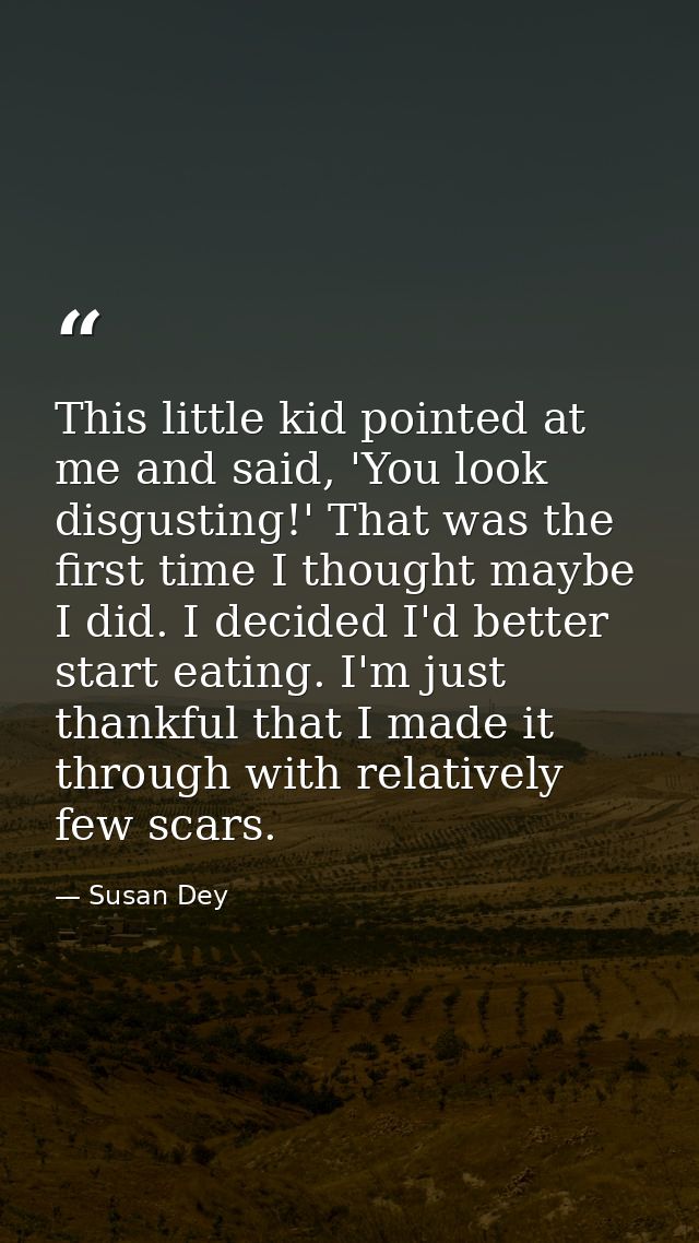 This little kid pointed at me and said, 'You look disgusting!' That was the first time I thought maybe I did. I decided  — Susan Dey